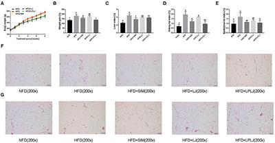 Effects of Lactobacillus plantarum FZU3013-Fermented Laminaria japonica on Lipid Metabolism and Gut Microbiota in Hyperlipidaemic Rats